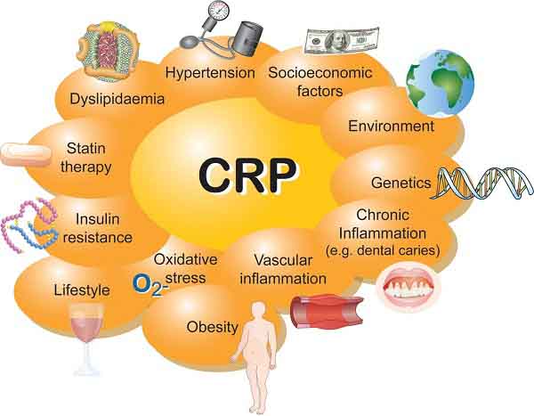 CRP là gì? Vai trò của xét nghiệm CRP đối với sức khỏe