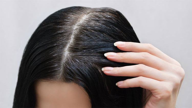 Nguyên nhân tóc bạc sớm và cách điều trị khắc phục