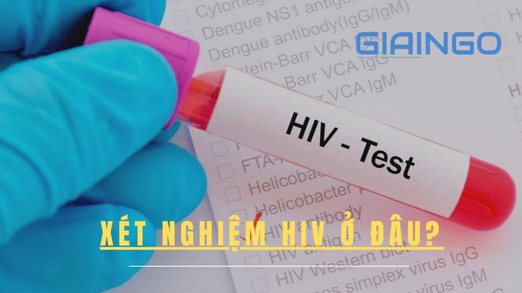 Xét nghiệm HIV ở đâu chính xác nhất? Dấu hiệu của bệnh HIV 1 Xét nghiệm HIV ở đâu?