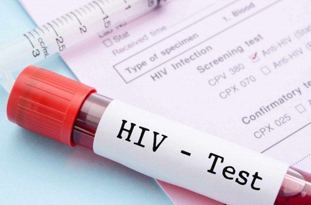 Xét nghiệm HIV ở đâu?