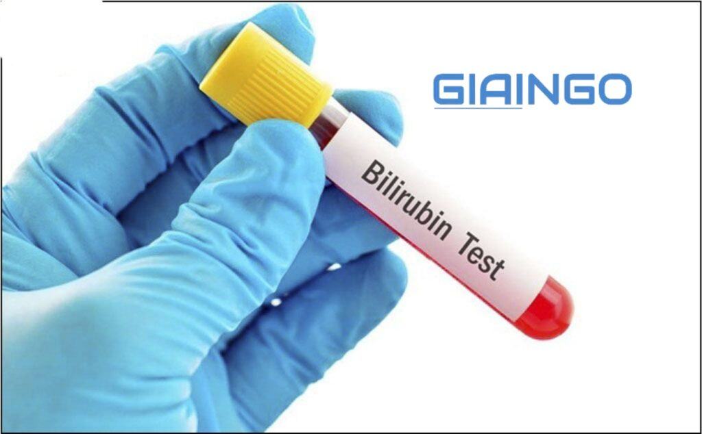 Bilirubin là gì? Ý nghĩa việc xét nghiệm bilirubin là gì? 1 Bilirubin là gì?
