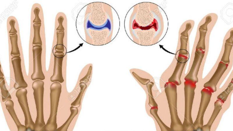 Sự khác nhau giữa xương tay và xương chân