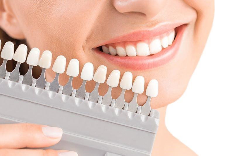 Bọc răng sứ thẩm mỹ là xu hướng làm đẹp nụ cười được nhiều người yêu thích 